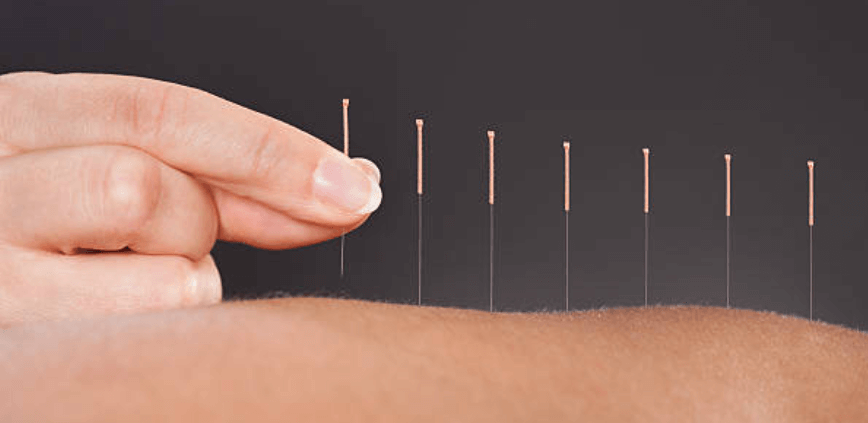 Akupunktur og stofskifte